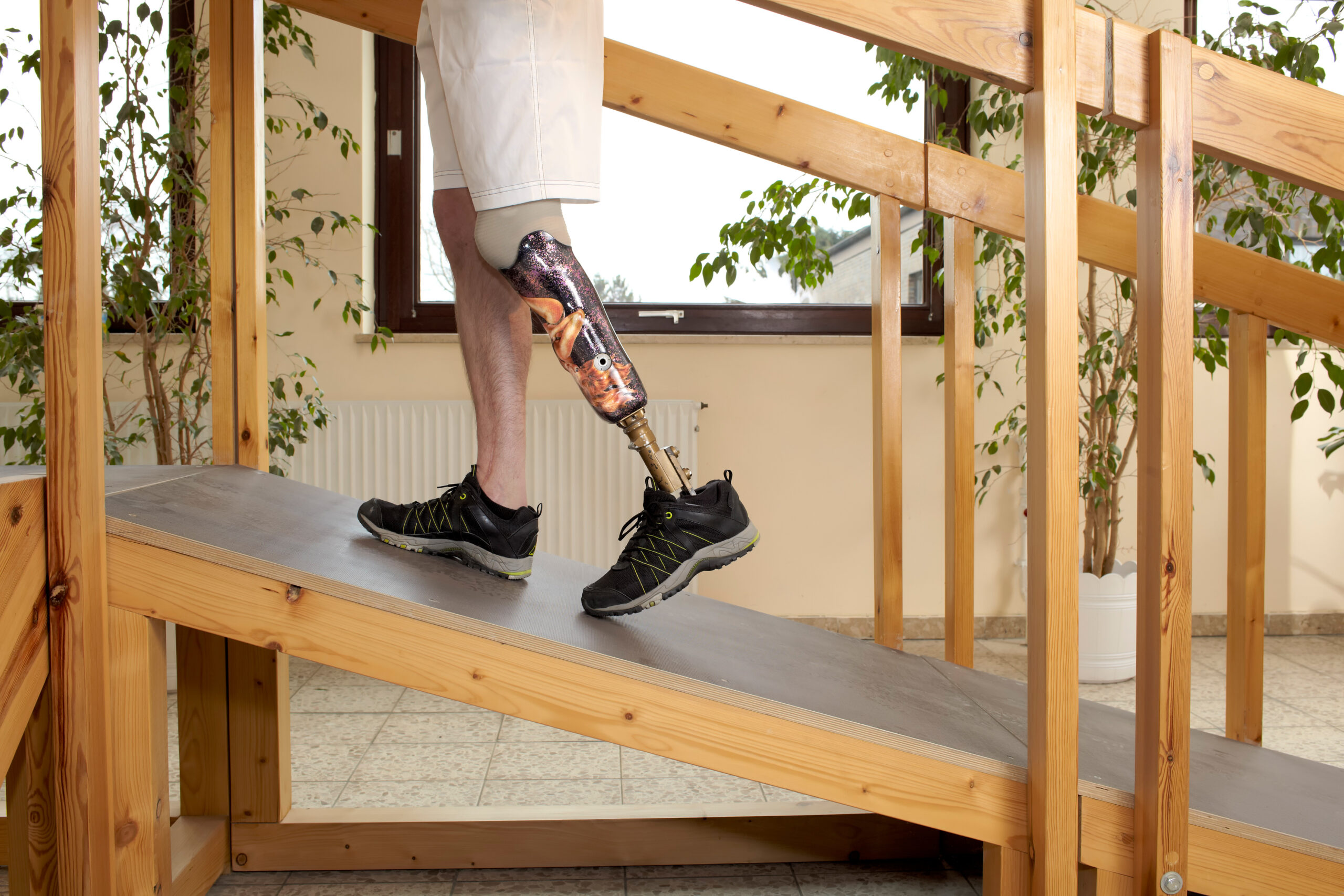 Male prosthesis wearer training to climb a slope unaided in a speical parcour or interior area where surfaces have been laid out to simulate realistic environmental situations